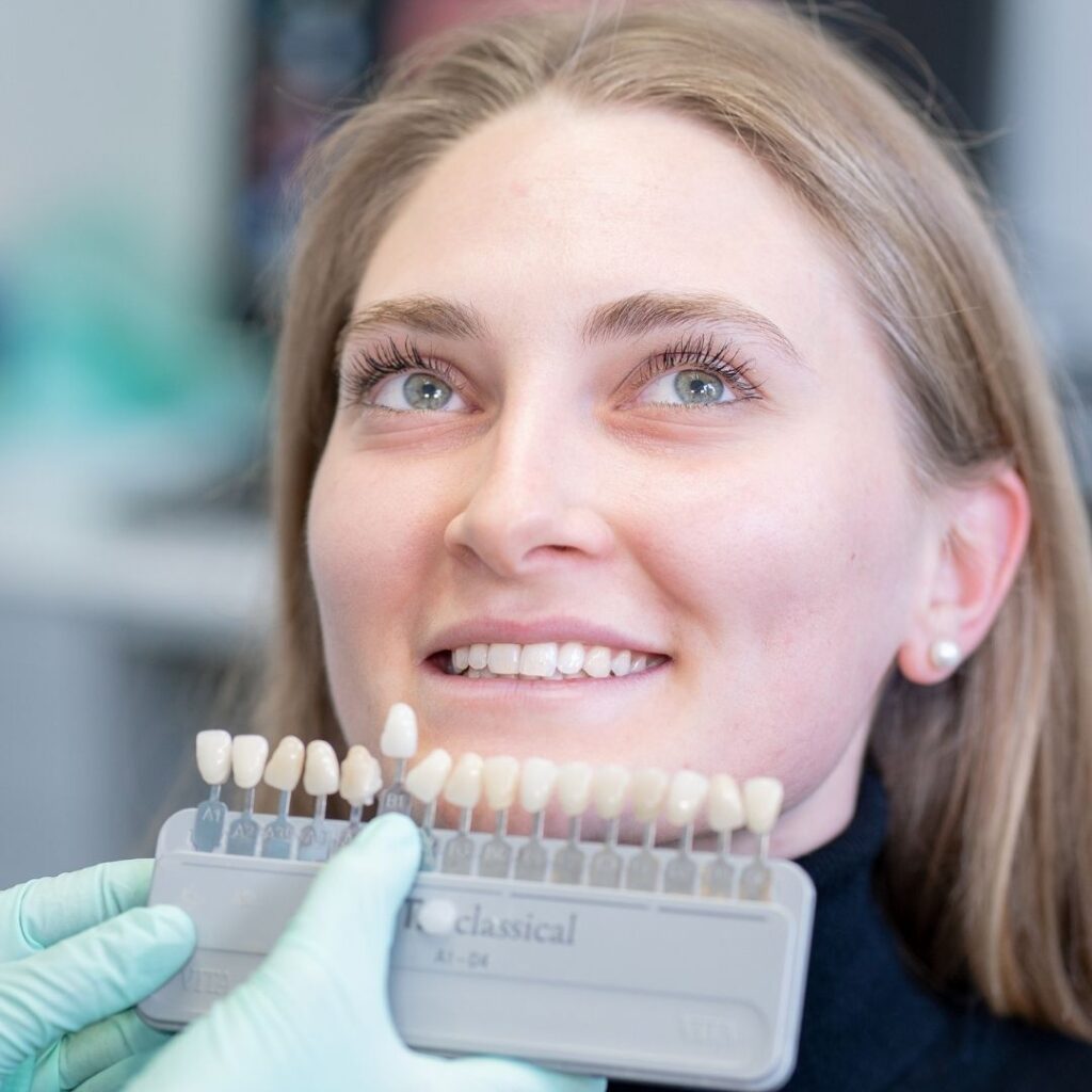 faccette dentali a Pinerolo